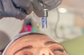 Micro Needling
